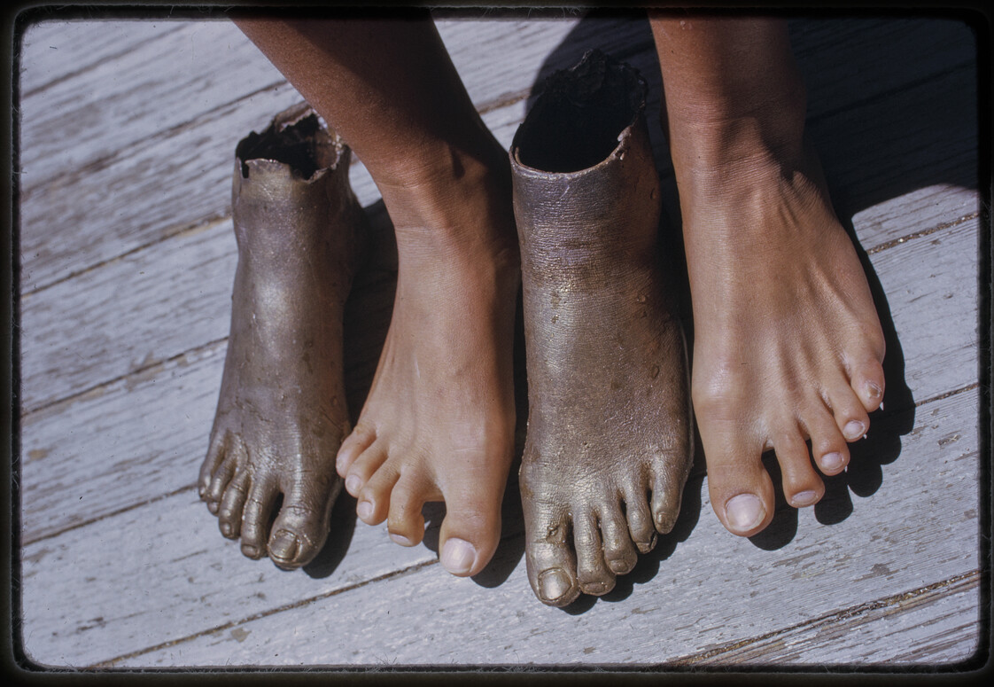 Photograph of a pair of bare feet standing between two bronze-colored cast feet on a wooden deck. The casts are broken at the ankles.